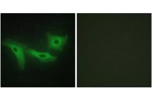 Immunofluorescence analysis of HeLa cells, using LRRK1 Antibody. (LRRK1 Antikörper  (AA 361-410))