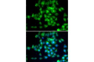 Immunofluorescence analysis of MCF7 cell using SIRT3 antibody.