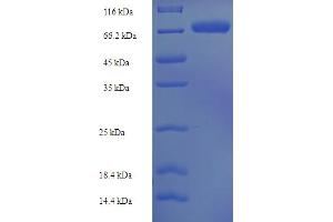 SDS-PAGE (SDS) image for Sulfite Oxidase (SUOX) (AA 80-545) protein (His-SUMO Tag) (ABIN5710440)