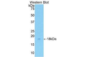 Western Blotting (WB) image for anti-Solute Carrier Family 12 (Sodium/Chloride Transporters), Member 3 (SLC12A3) (AA 3-146) antibody (ABIN1176282) (SLC12A3 Antikörper  (AA 3-146))