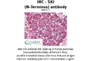 Image no. 1 for anti-SKI Proto-Oncogene (SKI) antibody (ABIN1739312) (SKI Antikörper)