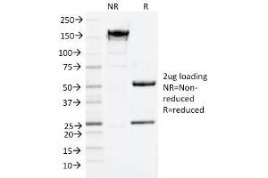 SDS-PAGE Analysis Purified NGFR Mouse Monoclonal Antibody (NGFR/1964). (NGFR Antikörper  (AA 281-421))