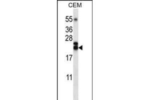 Western Blotting (WB) image for anti-Tumor Necrosis Factor (Ligand) Superfamily, Member 4 (TNFSF4) (AA 102-131) antibody (ABIN656220)