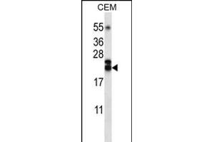 TNFSF4 Antibody (Center) (ABIN656220 and ABIN2845537) western blot analysis in CEM cell line lysates (35 μg/lane). (TNFSF4 Antikörper  (AA 102-131))