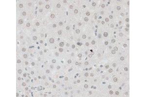 Immunohistochemistry of paraffin-embedded Rat liver using ZNF148 Polyclonal Antibody at dilution of 1:100 (40x lens).