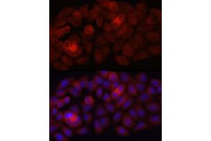 Immunofluorescence (IF) image for anti-Folate Receptor 1 (Adult) (FOLR1) antibody (ABIN7267223)