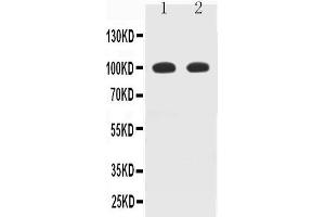 Observed bind size: 100KD (MAG Antikörper  (N-Term))