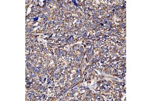 IHC analysis of PMPCA/INPP5 using anti-PMPCA/INPP5 antibody (ABIN7602722). (PMPCA Antikörper  (AA 99-525))