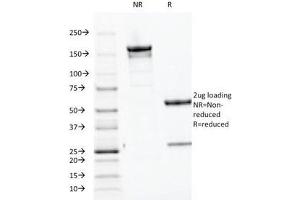 SDS-PAGE Analysis of Purified, BSA-Free Parathyroid Hormone Antibody (clone PTH/1174). (PTH Antikörper  (AA 32-115))