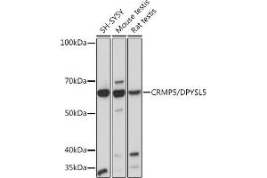 Western blot analysis of extracts of various cell lines, using CRMP5/DPYSL5 Rabbit mAb (ABIN7266774) at 1:1000 dilution.