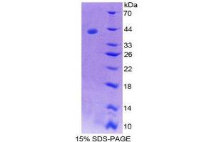 SDS-PAGE (SDS) image for Tachykinin 3 (TAC3) (AA 29-102) protein (His tag,GST tag) (ABIN2123375) (Tachykinin 3 Protein (TAC3) (AA 29-102) (His tag,GST tag))