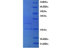 WAP Four-Disulfide Core Domain 2 (WFDC2) (AA 31-124) protein (His tag) expressed in mammalien cells