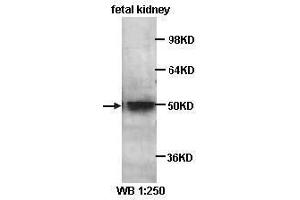 Western Blotting (WB) image for anti-Kruppel-Like Factor 8 (KLF8) antibody (ABIN1856579)