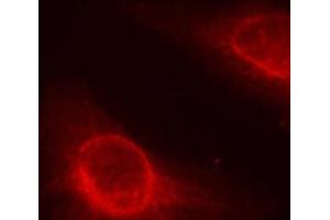 Immunofluorescence analysis of methanol-fixed HeLa cells using Phospho-CFL1(S3) Polyclonal Antibody (Cofilin Antikörper  (pSer3))