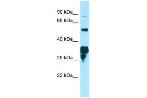 WB Suggested Anti-SPG21 Antibody Titration: 1.