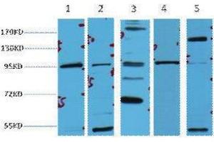 Western Blotting (WB) image for anti-Catenin, beta (CATNB) antibody (ABIN3178618) (beta Catenin Antikörper)