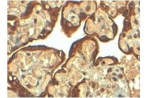 Image no. 3 for anti-Plasminogen Activator Inhibitor 1 (SERPINE1) (Internal Region) antibody (ABIN374547) (PAI1 Antikörper  (Internal Region))