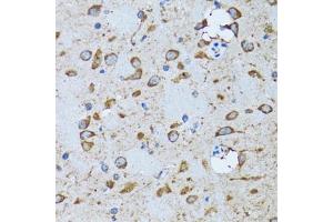 Immunohistochemistry of paraffin-embedded mouse brain using PDP1 antibody (ABIN6132860, ABIN6145404, ABIN6145405 and ABIN6221944) at dilution of 1:100 (40x lens). (PDP Antikörper  (AA 278-537))