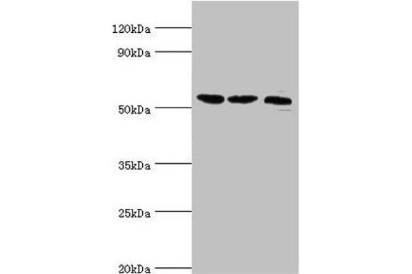 SMYD1 anticorps  (AA 1-350)