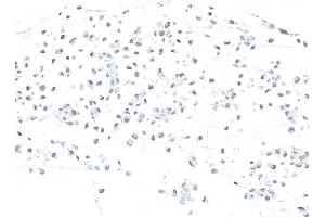 Immunocytochemistry (ICC) image for anti-Mismatch Repair Protein 2 (MSH2) (AA 625-675) antibody (ABIN7453978) (Rekombinanter MSH2 Antikörper  (AA 625-675))