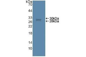 Detection of Recombinant CASP8, Human using Polyclonal Antibody to Caspase 8 (CASP8) (Caspase 8 Antikörper  (AA 7-201))