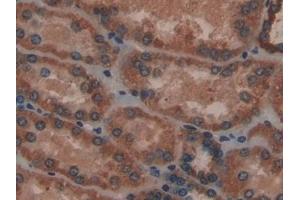 Immunohistochemistry (IHC) image for anti-NADH Dehydrogenase (Ubiquinone) 1, alpha/beta Subcomplex, 1, 8kDa (NDUFAB1) (AA 5-129) antibody (ABIN7439897)