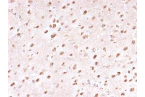 Formalin-fixed, paraffin-embedded human Brain stained with Ubiquitin-Monospecific Mouse Monoclonal Antibody (UBB/1748).