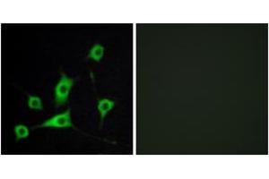 Immunofluorescence analysis of LOVO cells, using CRBP III Antibody. (Retinol Binding Protein 5 Antikörper  (AA 10-59))