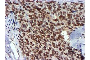 Image no. 10 for anti-Ubiquitin Specific Peptidase 7 (Herpes Virus-Associated) (USP7) antibody (ABIN1498592) (USP7 Antikörper)