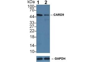 Western Blotting (WB) image for anti-Caspase Recruitment Domain Family, Member 9 (CARD9) (AA 26-283) antibody (ABIN7443479)