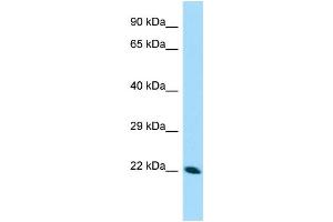 WB Suggested Anti-CDNF Antibody Titration: 1. (CDNF Antikörper  (N-Term))