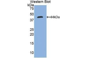 Western blot analysis of the recombinant protein. (Nephrin Antikörper  (AA 39-106))
