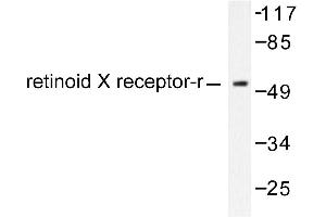 Image no. 1 for anti-Retinoid X Receptor, gamma (RXRG) antibody (ABIN271807) (Retinoid X Receptor gamma Antikörper)