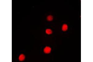 Immunofluorescent analysis of PAX9 staining in Jurkat cells. (PAX9 Antikörper  (Center))