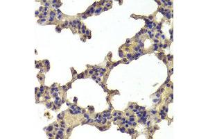 Immunohistochemistry of paraffin-embedded Rat lung using HDAC7 antibody at dilution of 1:100 (x400 lens). (HDAC7 Antikörper)
