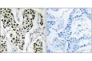 Immunohistochemistry (IHC) image for anti-Zinc Finger CCCH-Type Containing 4 (ZC3H4) (AA 771-820) antibody (ABIN1535474)