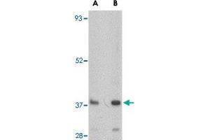 Western blot analysis of FBXL20 in A-20 cell lysate with FBXL20 polyclonal antibody  at (A) 0. (FBXL20 Antikörper  (N-Term))