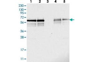 Western blot analysis of Lane 1: RT-4, Lane 2: U-251 MG, Lane 3: Human Plasma, Lane 4: Liver, Lane 5: Tonsil with BSDC1 polyclonal antibody  at 1:250-1:500 dilution. (BSDC1 Antikörper)