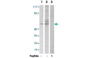 Western blot analysis of extracts from HepG2 cells (Lane 1 and 3) and 293 cells (Lane 2), using DAB1 polyclonal antibody . (DAB1 Antikörper)