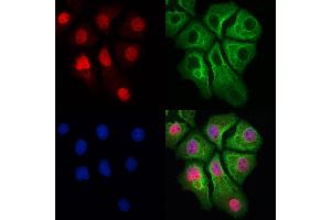 ABIN6265927 and ABIN6273024 staining Hela cells by IF/ICC. (USP39 Antikörper  (N-Term))