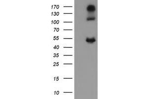 Image no. 2 for anti-Carbonic Anhydrase 12 (CA12) antibody (ABIN1497065)