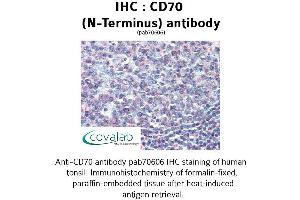 Image no. 1 for anti-CD70 Molecule (CD70) (N-Term) antibody (ABIN1732877) (CD70 Antikörper  (N-Term))