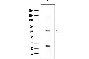 Western blot analysis of lysates from Rat muscle, using Cytochrome P450 4F12 Mouse Monoclonal Antibody at 1/1000 dilution.
