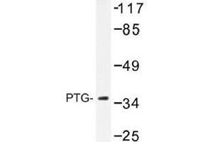 Image no. 1 for anti-Protein Phosphatase 1, Regulatory Subunit 3C (PPP1R3C) antibody (ABIN317934) (PPP1R3C Antikörper)