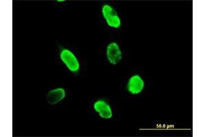 Immunofluorescence of purified MaxPab antibody to SUMO3 on HeLa cell. (SUMO3 Antikörper  (AA 1-103))