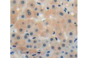 IHC-P analysis of liver tissue, with DAB staining. (CMTM8 Antikörper  (AA 1-173))