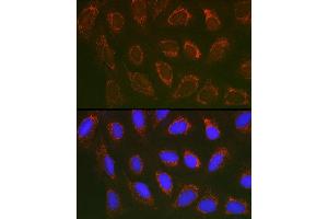 Immunofluorescence analysis of U2OS cells using SLC25 Rabbit pAb (ABIN1682768, ABIN3017839, ABIN3017840 and ABIN6220286) at dilution of 1:100 (40x lens). (SLC25A6 Antikörper  (AA 1-298))