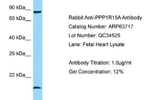 Western Blotting (WB) image for anti-Protein Phosphatase 1, Regulatory (Inhibitor) Subunit 15A (PPP1R15A) (N-Term) antibody (ABIN971447) (GADD34 Antikörper  (N-Term))
