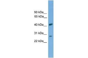 Human THP-1; WB Suggested Anti-SLC25A37 Antibody Titration: 0. (SLC25A37 Antikörper  (C-Term))