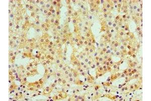 Immunohistochemistry of paraffin-embedded human adrenal gland tissue using ABIN7146438 at dilution of 1:100 (CAMK1G Antikörper  (AA 217-476))